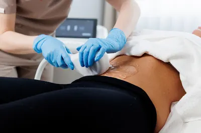 Renew Skin - Medycyna Estetyczna I Kosmetologia I Odmładzanie laserowe